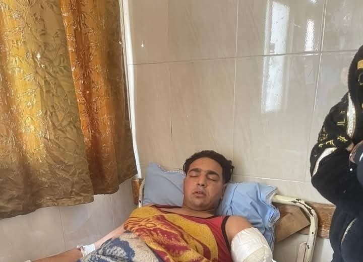 العامل المصاب في حادث سيرك طنطا