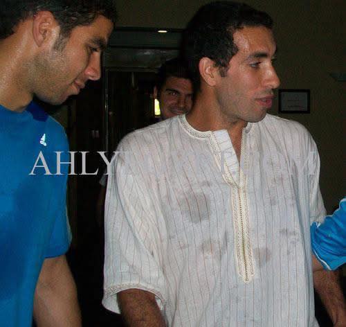 محمد أبو تريكه
