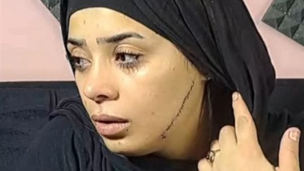 &nbsp;تشوية وجه عروسة بـ 41 غرزة في مصر القديمة&nbsp;