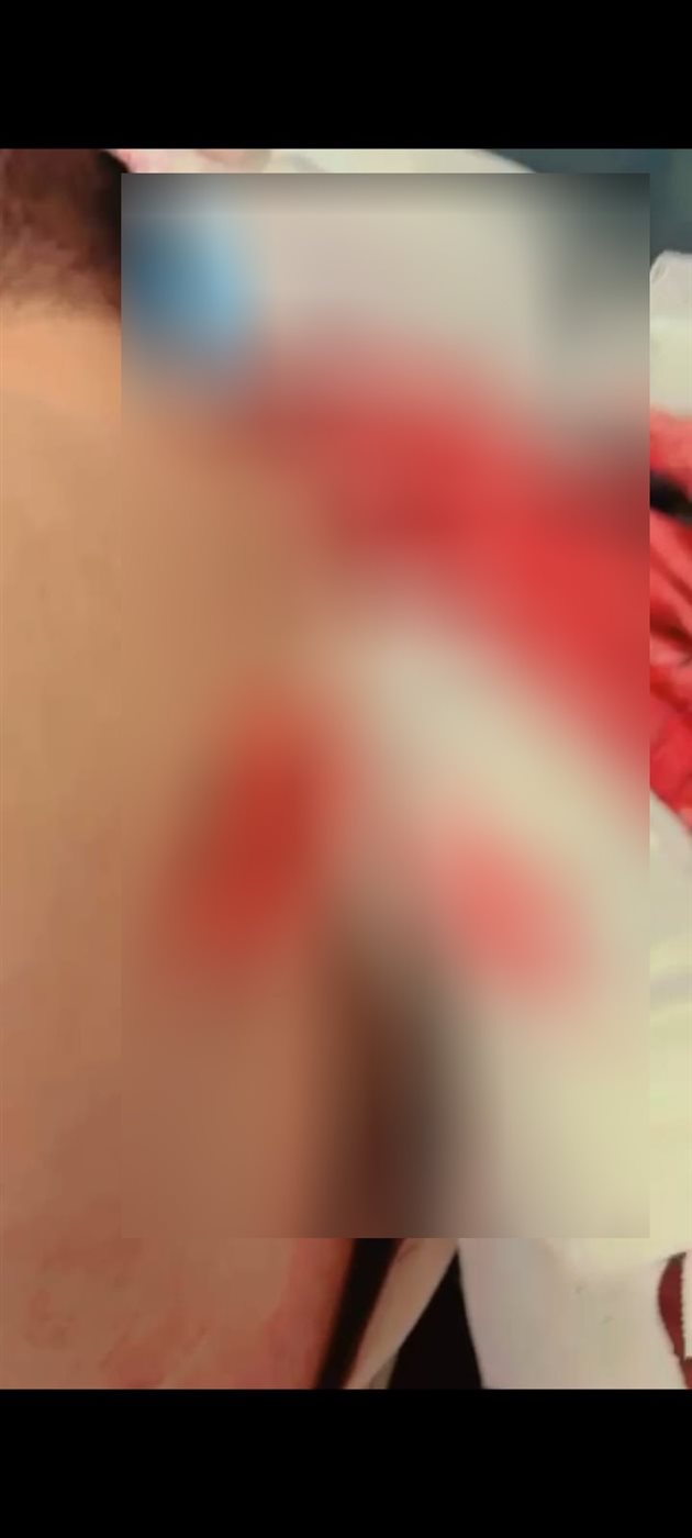 المجنى عليه