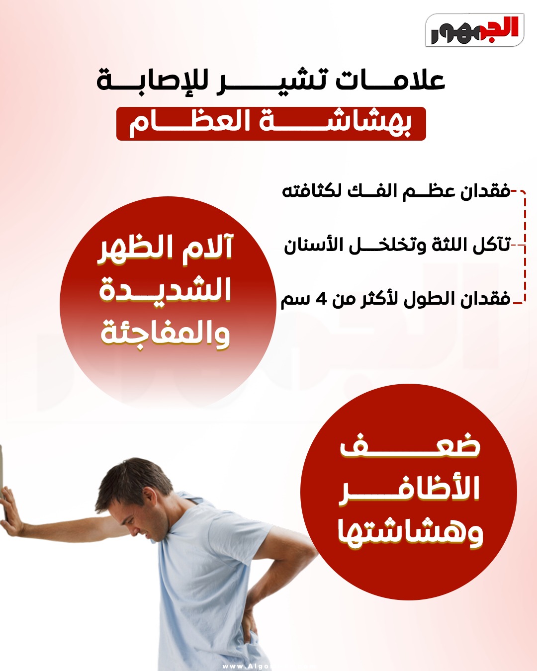 علامات هشاشة العظام