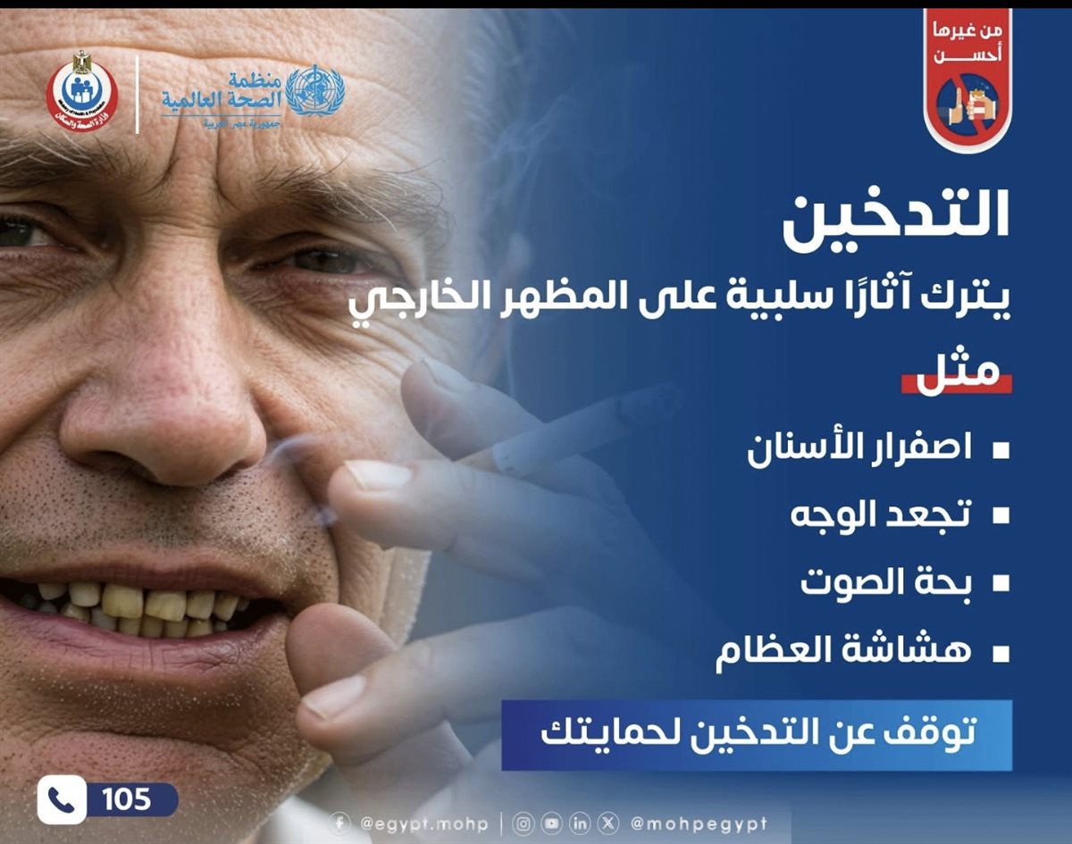 التدخين&nbsp;