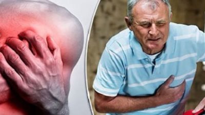 التدخين يسبب تصلب الشرايين .. ما هى أعراضه ؟