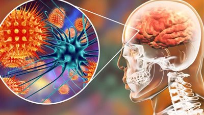 ما لا تعرفه عن فيروس نيباه.. أعراض الإصابة والوقاية والعلاج