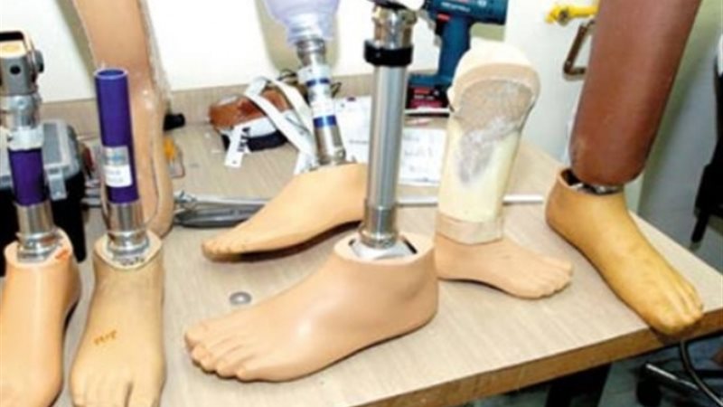 أطراف صناعية