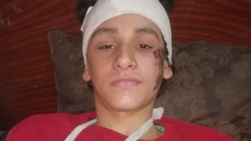 الناجي الوحيد من الحادث