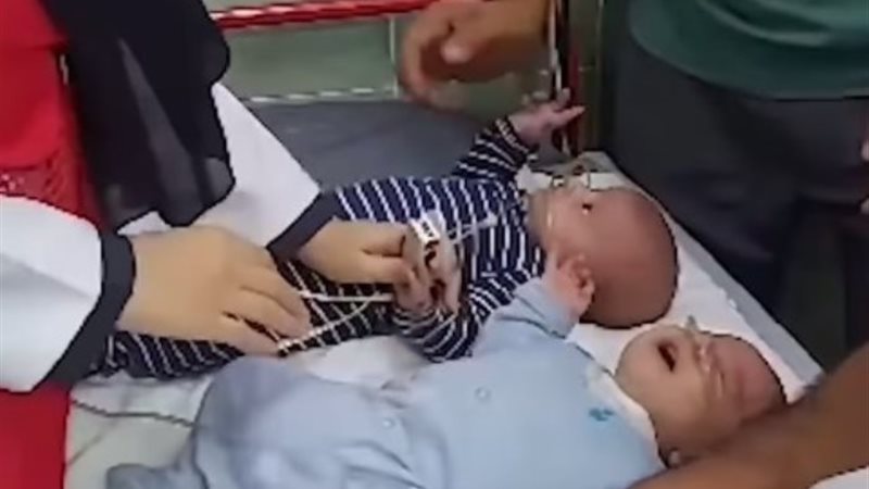 نجاة توأم رضيع من قــصف الاحتلال