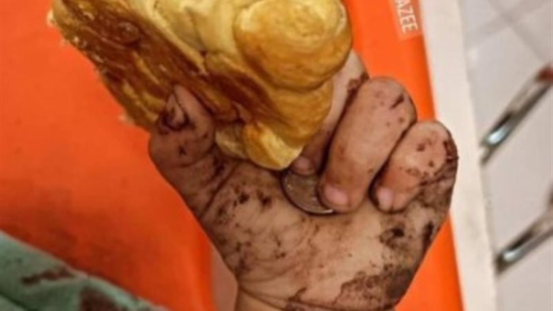 لقمة عيش ملطخة بدماء طفلة فلسطينية في مستشفي المعمداني
