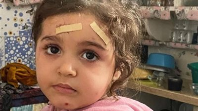 ملامح بريئة وعيون حزينة.. معاناة الطفلة الفلسطينية «جوليا»
