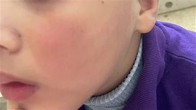 أولياء الأمور يطالبون بمحاسبة المسؤولين في واقعة تلميذ الغربية