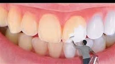  مشروبات شائعة تسرق بياض أسنانك دون أن تشعر