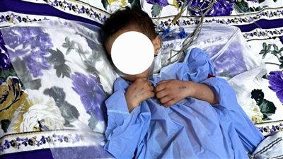 فريق طبي بجامعة سوهاج ينجح في إنقاذ حياة طفل تعرض لحادث مروع