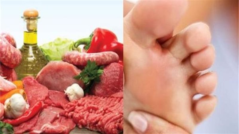 نصائح لمرضى النقرس