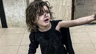 «الاحتلال قتل براءتها».. معاناة طفلة فلسطينية فقدت والديها