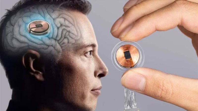 Neuralink