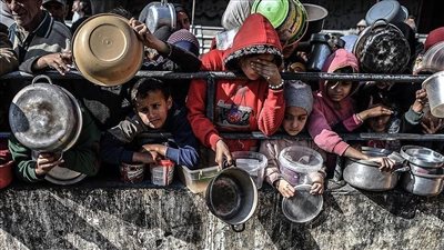 غزة تموت جوعًا.. وطفولة كاملة تهددها العاهات الدائمة