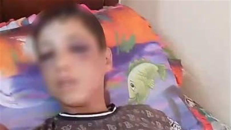 المجني عليه