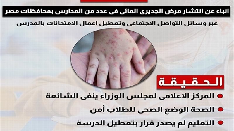 شائعة انتشار الجديرى بالمدارس