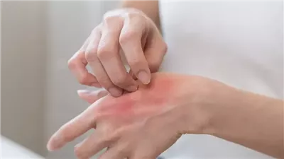 استشاري يوضح أسباب ضعف المناعة وزيادة الحساسية 