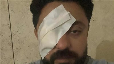 أمن الغربية يضبط المتهمين بالاعتداء على شاب فقد عينه داخل مستشفى بالمحلة