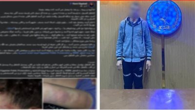 كنت بأدبه.. ضبط أب تعدى على نجله بالضرب وتسبب فى إصابته