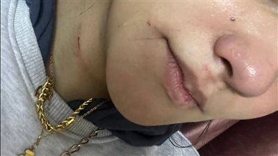شاب يشرع في إنهاء حياة فتاة بالمعادي انتقاما منها بعد خلاف عاطفي 