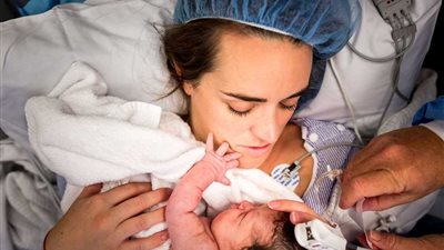  ولادات قيصرية في مصر تتجاوز المعايير العالمية وتثير مخاوف صحية