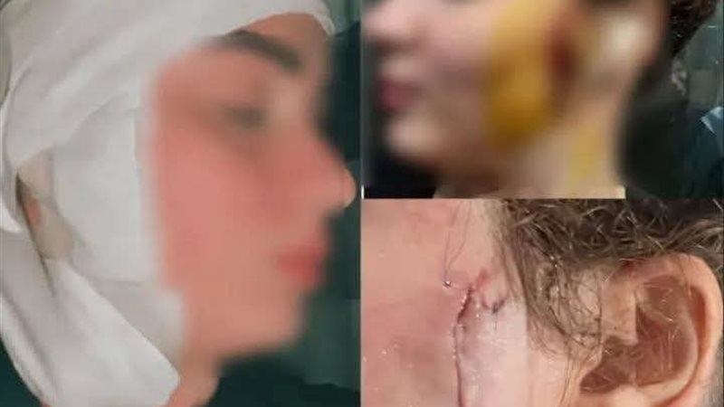 المجنى عليها 