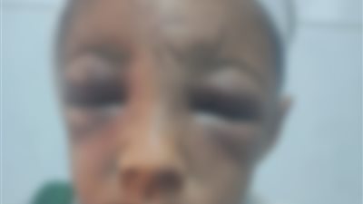 بسبب 10 جنيهات.. أب يعذب طفله بعد فقدانها أثناء شراء سجائر بالمحلة