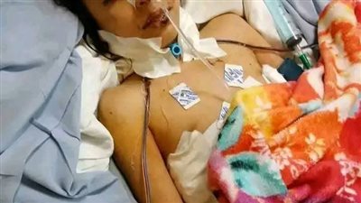 جريمة أسرية تهز صفط اللبن سيدة وطفلتها بين الحياة والموت