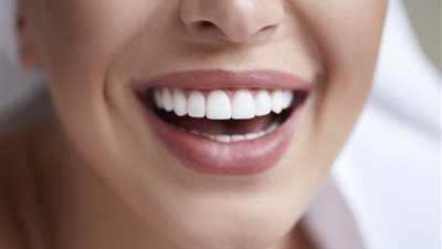 ابتسامة ناصعة من 