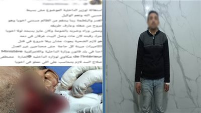 مشاجرة الجيرة تنتهي بجرح قطعي في الوجه.. وهذه عقوبة المتهم