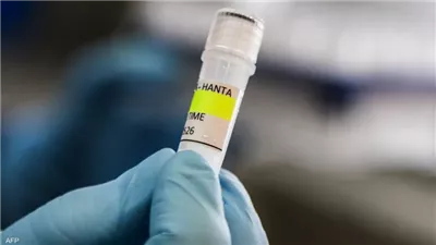 منظمة الصحة العالمية: تفشي “هانتا” لا يُقارن بكوفيد.. والخطر العام “ضعيف”