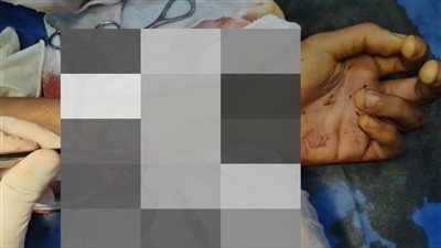 كواليس إصابة لاعب الزمالك بقطع بالشريان بعد محاولة سرقته بميت عقبة بالجيزة 