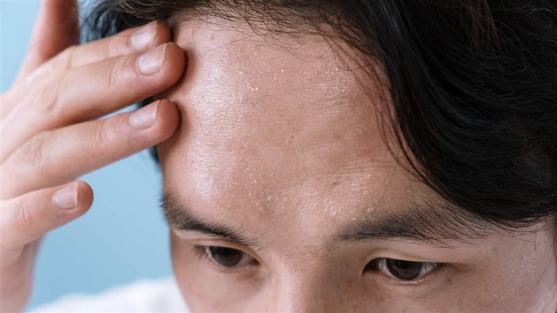 أعراض الغدة النخامية 